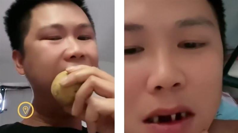 學電影咬冰凍馬鈴薯　蠢男斷了3顆牙