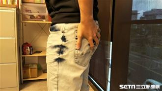 放屁像臭雞蛋味不是消化差 1種氣味快就醫