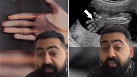 圖／翻攝dr.karanr TikTok