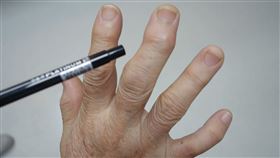 聯新國際醫院影像醫學科醫師盧炳昇表示，手指退化性關節炎好發於50歲以上中年女性（圖／聯新國際醫院提供）