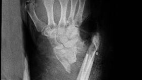 宜蘭,棍棒,老翁,擋車,攔車,毆打,暴力