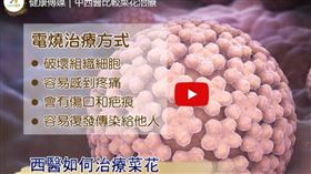 ▲中醫 西醫怎麼治菜花（圖／翻攝自黃慶雲醫師YT） 