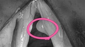 萬芳醫院提供＋翻攝自pixabay