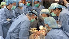 臉部移植（高醫提供）