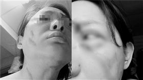 ▲北市王婦提醒女鄰居戴好口罩，卻遭對方猛砍30多刀。（圖／翻攝自臉書社團《爆廢公社公開版》）