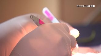 大二就可縫合病患？醫學系內部分級曝