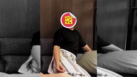 岳雲鵬,病危,脂肪瘤,暴瘦（圖／翻攝自微博）