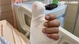 花蓮,手指,咬,斷裂,所長,員警