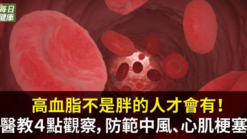注意！高血脂不是胖的人才會有！