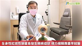 名家專用／NOW健康／書田診所眼科副院長廖士傑表示，全身性紅斑性狼瘡為全身性自體免疫疾病，約有15%的患者會發生眼部症狀，可能會有視力模糊、畏光、乾澀、刺痛、異物感、流淚等情形。(勿用)