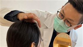 皮膚科醫師,掉髮,換季,秋冬,冷氣團,毛囊