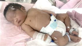 林峻宏醫師表示，寶寶出生後即入保溫箱加強觀察與照護，目前已回到媽媽懷抱健康返家（圖／台北醫院提供）