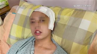 遭毆男大生「耳朵積血水」！最想回家