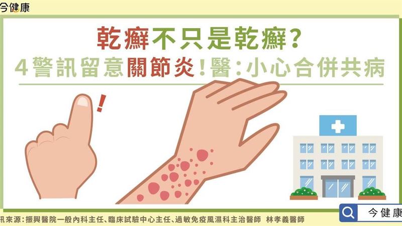 乾癬不只是乾癬？出現四大警訊要當心