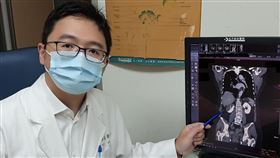 腰劇烈疼痛誤以為腎結石　檢查發現竟是「腎中風」（圖／大千綜合醫院提供）