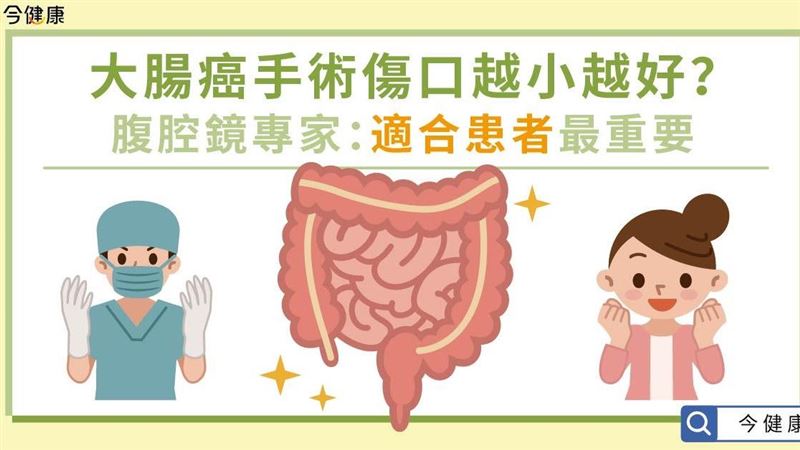 大腸癌手術傷口越小越好？恢復越快？