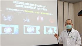 奇美醫學中心,攝護腺,解尿,不順,泌尿科,手術