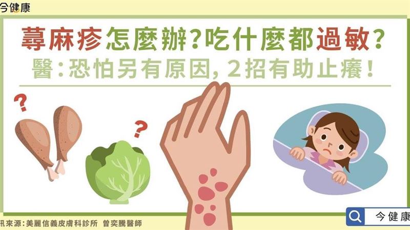 蕁麻疹怎麼辦？醫：恐另有原因