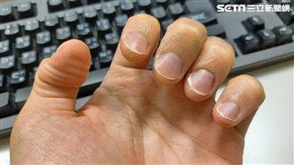 她蒐集指甲竟賣出每斤1320元　專家揭用途