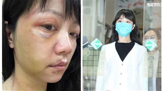 高嘉瑜還原施暴那晚：滿嘴血、快死了