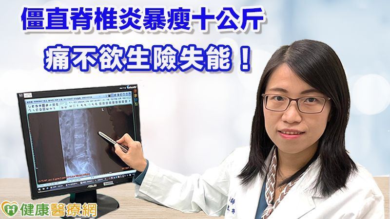 僵直脊椎炎暴瘦十公斤痛不欲生