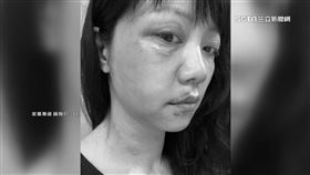 高嘉瑜,林秉樞,蔡壁如,鍾沛君,求救,家暴