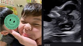 小亨堡突曬寶寶超音波照片，嚇壞不少網友。（圖／翻攝自IG）