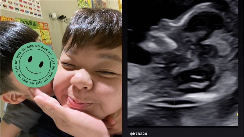 小亨堡突曬「寶寶超音波照」網全嚇瘋