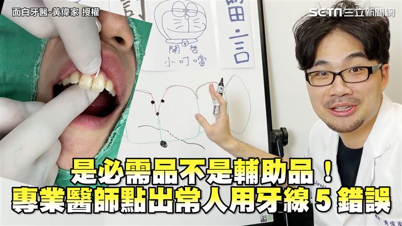 牙線是必需品！　醫師點出５錯誤用法