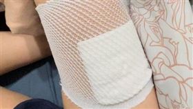 D卡／吃板橋餐廳被燙傷！店經理嘻笑：「沒錢陪醫藥費」。（圖／翻攝自Dcard）