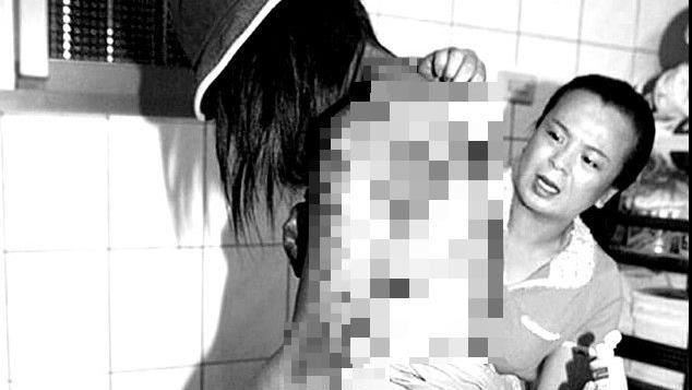 少婦出軌遭男友暴打　全身瘀傷如刺青