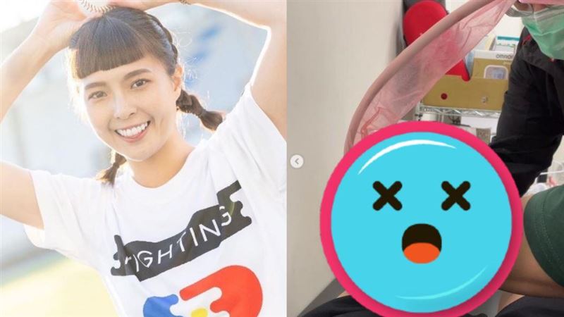 才剛破全明星紀錄　黃沐妍突曬傷勢照