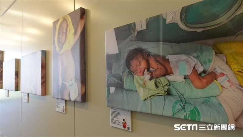 在媽媽肚裡就受傷的孩子　努力想活著