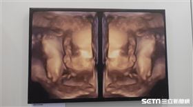 「最初的感動」2／記者張雅筑攝