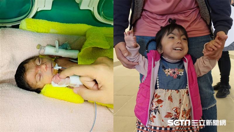 醫診斷活不過5歲　母牽她小手不放棄