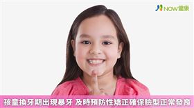 
名家專用／NOW健康／碧礽牙醫林逸豪醫師提醒，倘若家長期望能讓孩子的臉型和齒列更好看，愈早開始進行預防性矯正，愈能快速達到理想中的狀態。(勿用)