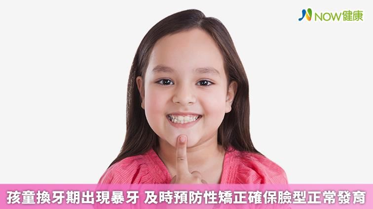 孩童換牙期出現暴牙預防性矯正助發育