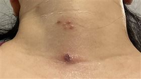 桃園,防疫旅館,蟲,隔離（圖／翻攝畫面）