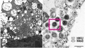 ｏｍｉｃｒｏｎ（照片來源：香港大學李嘉誠醫學院（港大醫學院）病理學系臨床教授黎國思教授、公共衛生學院譚華正基金教授（醫療科學）兼病毒學講座教授裴偉士教授，及香港大學電子顯微鏡研究所。）