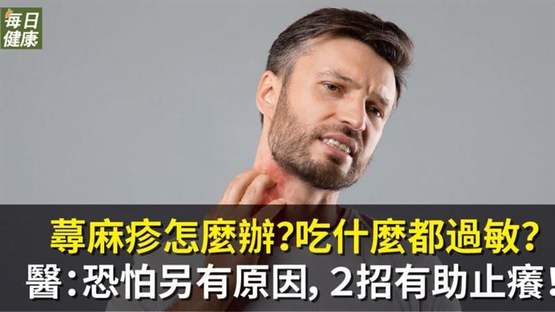 蕁麻疹該要怎麼辦？吃什麼都過敏？
