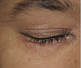 身體1部位最先看出衰老　醫揭7招延緩老化