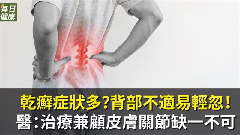 乾癬症狀多？背部不適易輕忽！