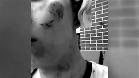 他半夜開車！陌生男子「突開車門」狂咬一通　原因超無言（圖／翻攝自極目新聞微博）