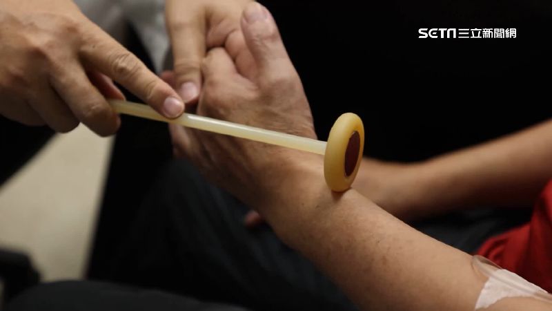 神經罕病認定難！醫：增臨床認定彈性