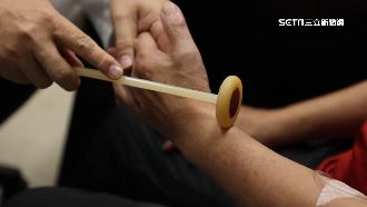 神經罕病認定難！醫：增臨床認定彈性