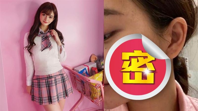 甜美AV名模曬真實照！臉潰爛嚇壞粉