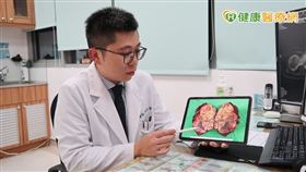 羅少喬醫師指出，肝臟切除手術成功率高達97%，如今手術技術與術後照護進步，不只出血量少、疼痛度降低，也能大幅降低併發症發生，縮短恢復期。