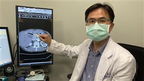 肝癌(長安醫院提供)