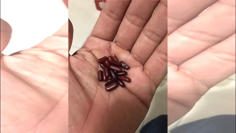女兒撿「一把紅豆」要煮湯！網全嚇壞