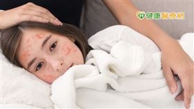 眾多病毒當中水痘屬於傳播力很強的疾病，只要家中一人得到，其他未得過也未接種過疫苗的家人也非容易被感染到，其家庭二次侵襲率高達85~90%。